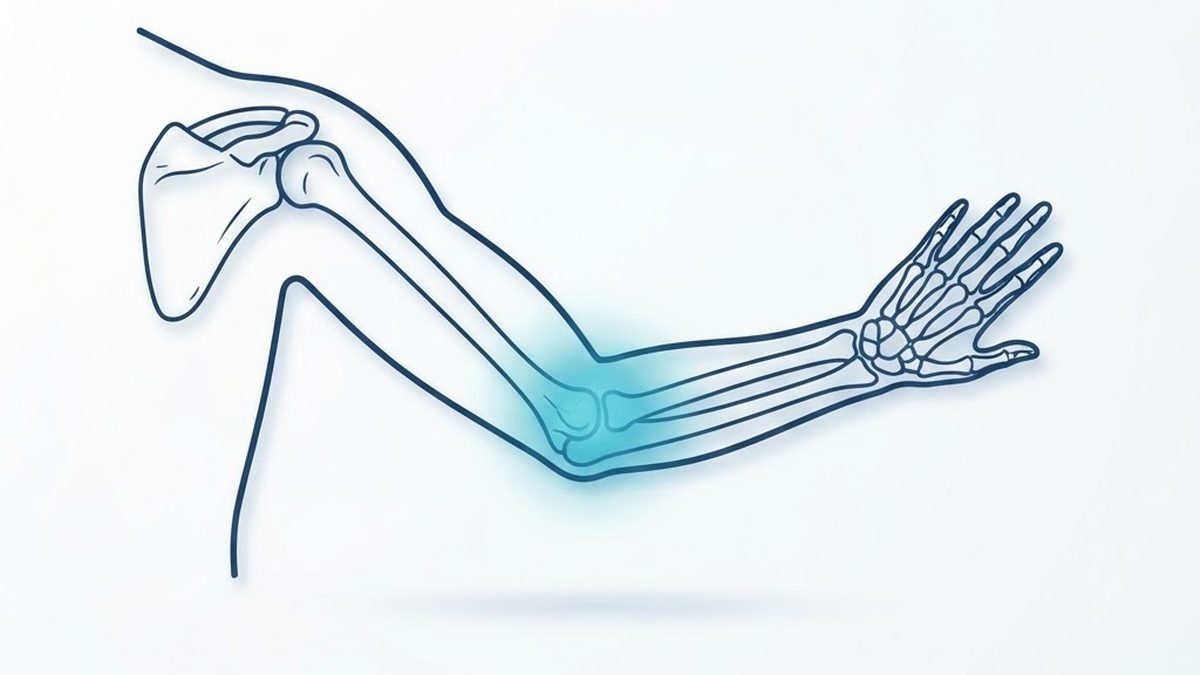 Medical diagram of the arm and elbow